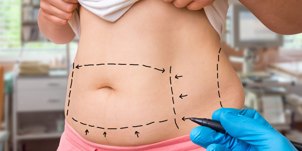 questions chirurgie esthetique