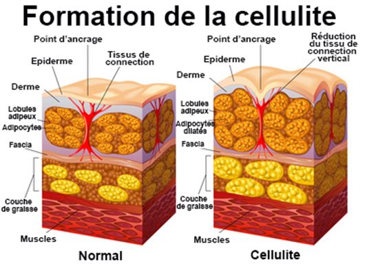 formation de la cellulite
